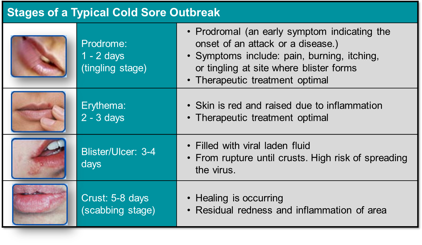 cold sores 3